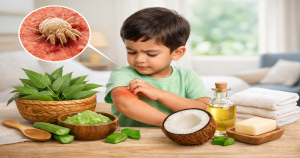 শিশুদের স্ক্যাবিস দূর করার ঘরোয়া উপায়