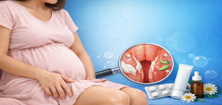 সাদা স্রাব ও চুলকানি.png