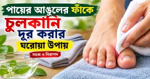 পায়ের আঙুলের ফাঁকে চুলকানি দূর করার ঘরোয়া উপায় কী?